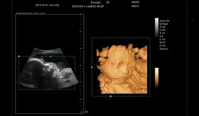 3D 4D Imaging(001)