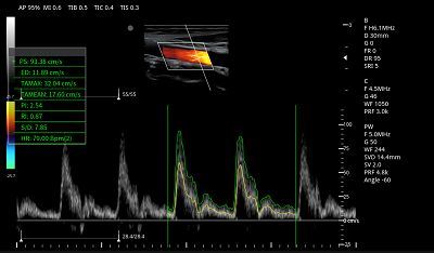 CCA PW Auto Trace