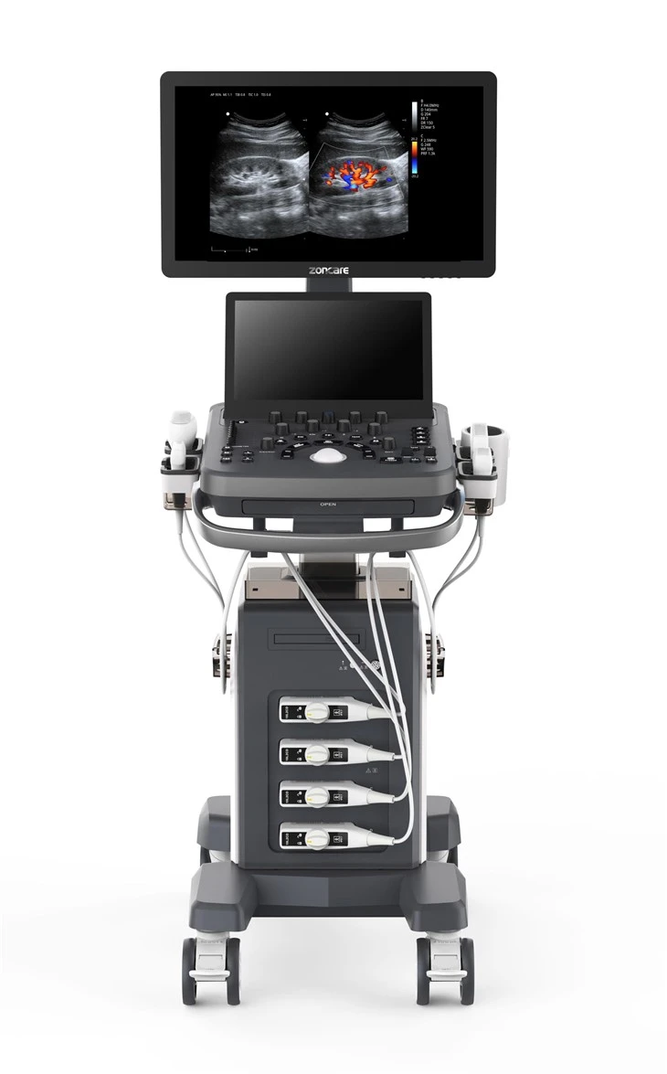 Compact Color Doppler Imaging Ultrasound